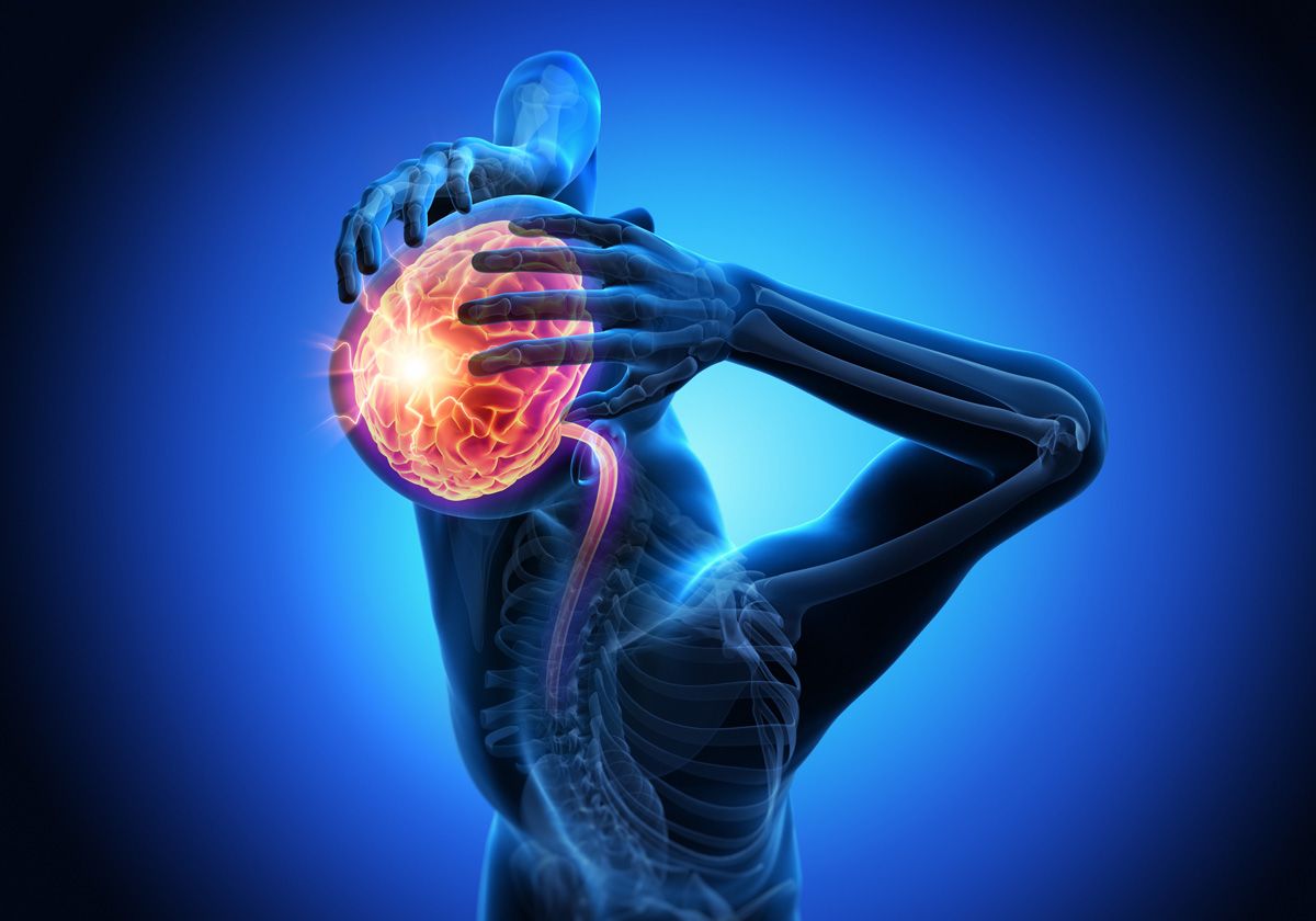 انواع سردرد های خطرناک - دکتر نوید فرزین