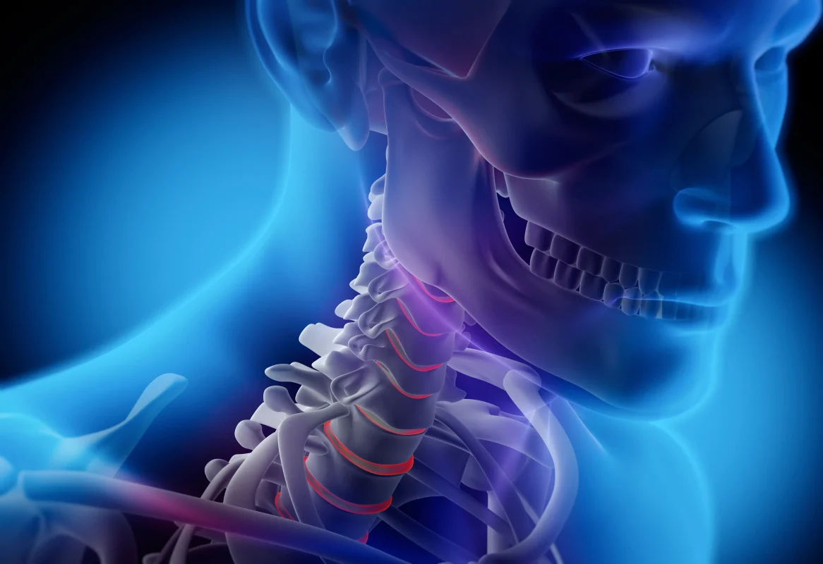 هزینه جراحی دیسک گردن در شیراز