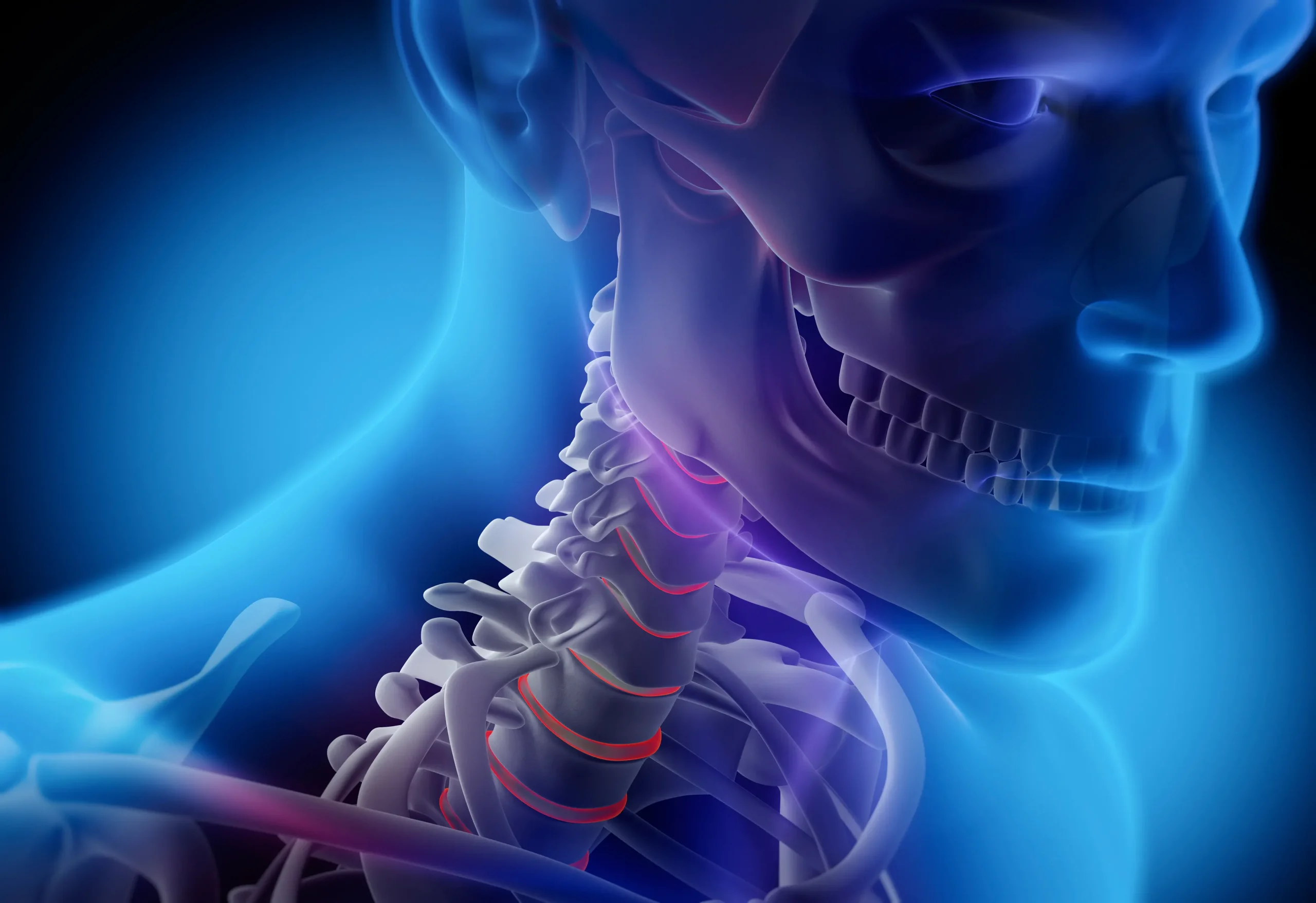 هزینه جراحی دیسک گردن در شیراز