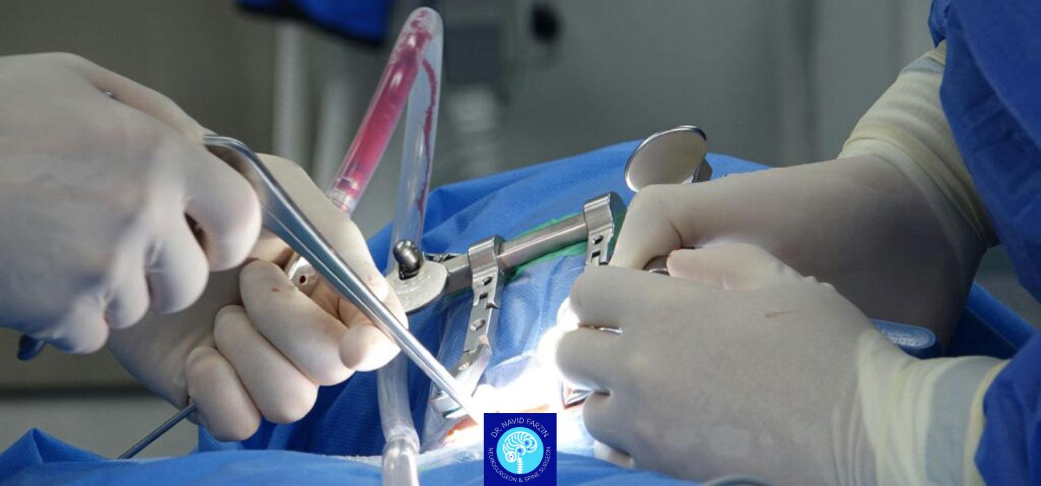 چطور برای جراحی مغز یا نخاع آماده شویم؟