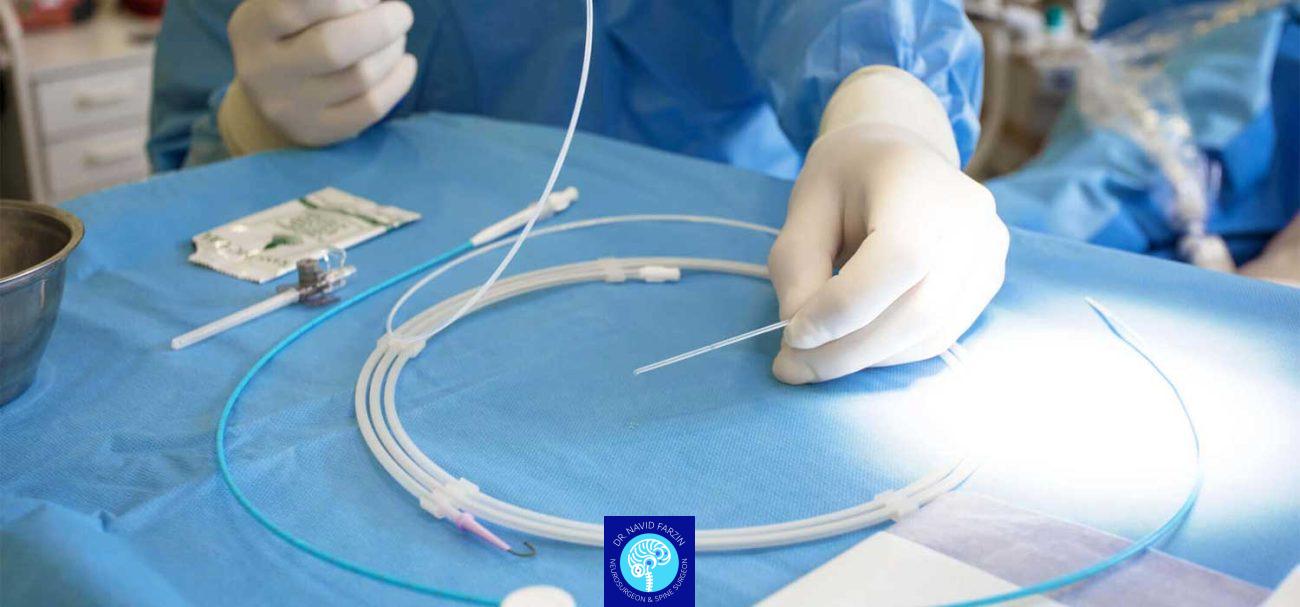 جراحی کم تهاجمی مغز و نخاع در شیراز | دکتر نوید فرزین