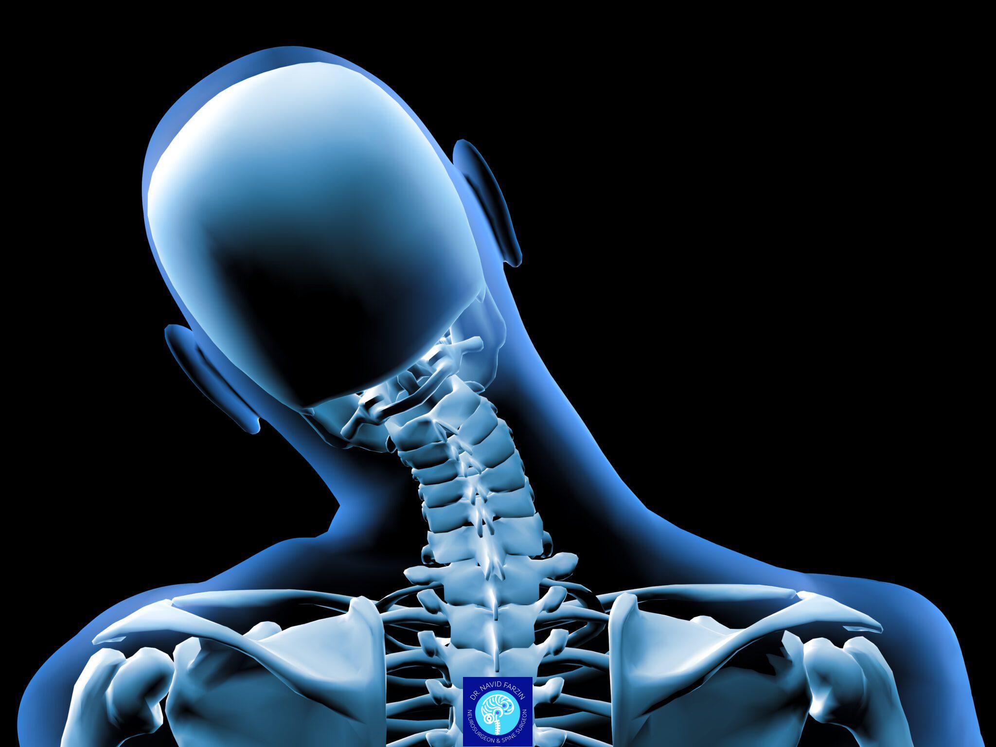 هزینه جراحی دیسک گردن در شیراز