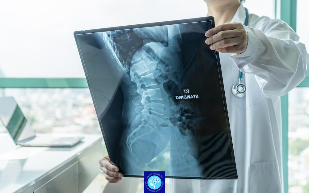 عوارض تاخیر در درمان تنگی کانال نخاعی