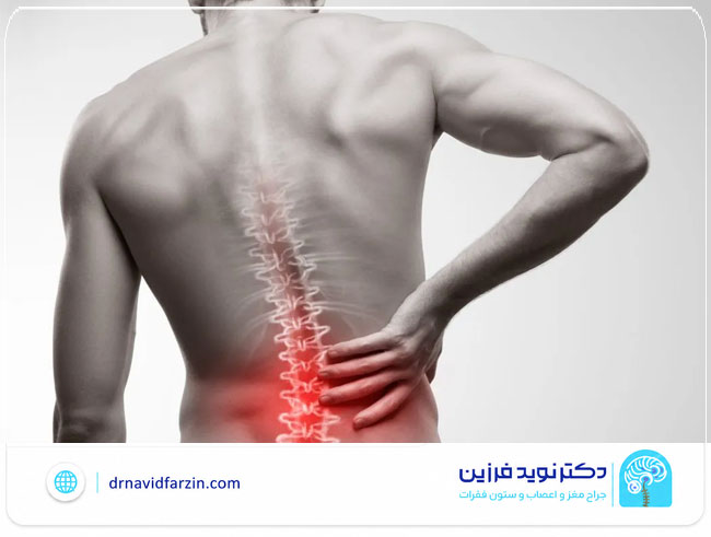 چه علائمی نشان می‌دهد دیسک کمر جدی است؟