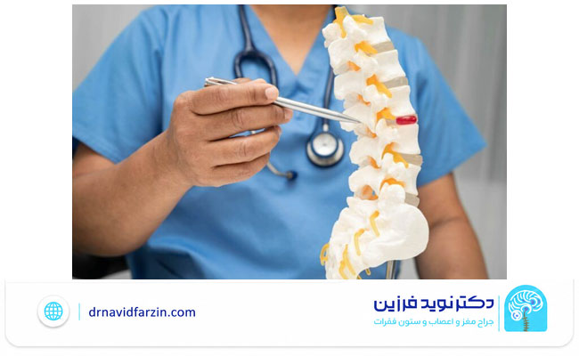 چه زمانی بیمار به جراح دیسک کمر نیاز دارد؟