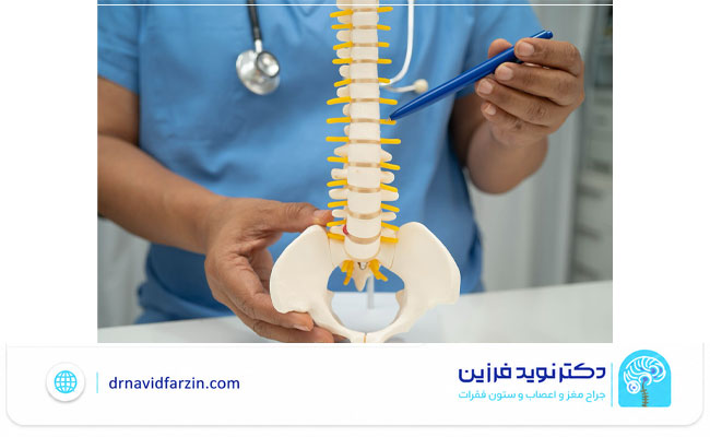 چه زمانی تنگی نخاع نیاز به جراحی دارد؟