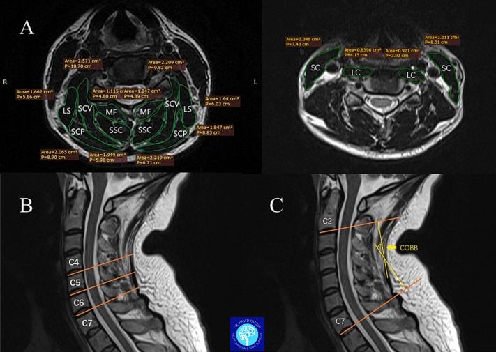 نقش MRI در تصمیم‌گیری برای جراحی چیست؟