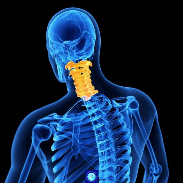 بررسی MRI دیسک گردن و فشار واردشده بر عصب