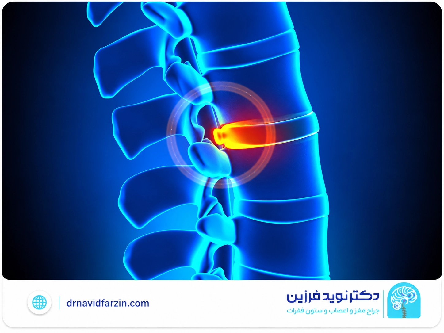 چه زمانی مراجعه به جراح ستون فقرات لازم‌تر می‌شود؟